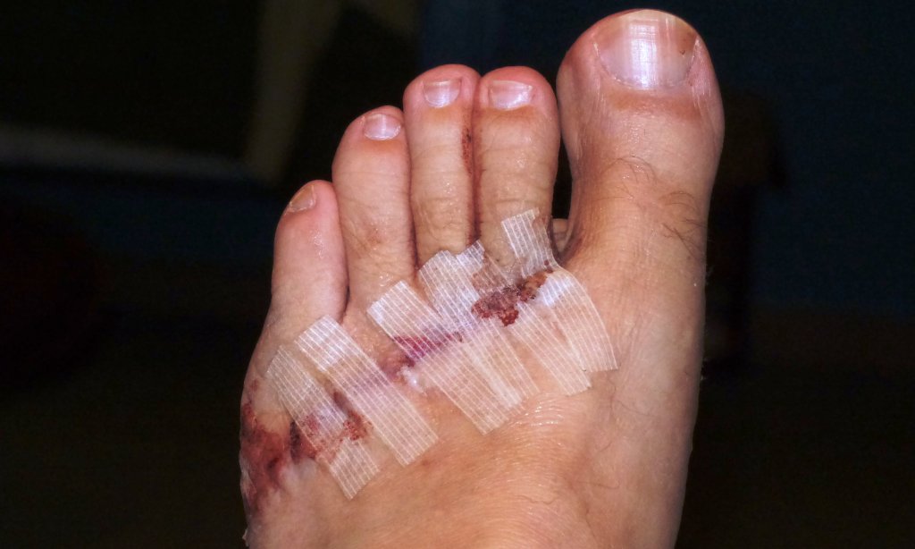 foot.JPG
