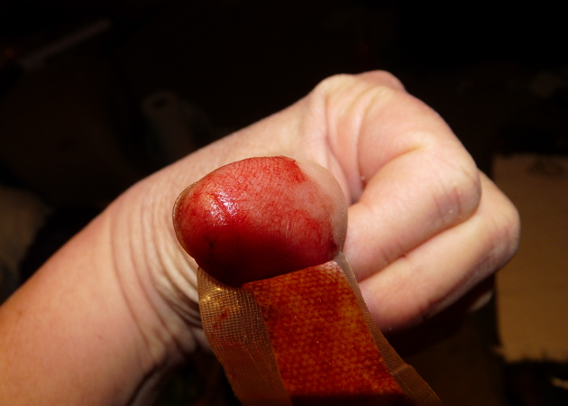 Thumb.jpg